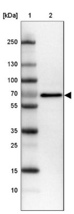 IGF2BP1 Antibody, Novus Biologicals:Antibodies:Primary Antibodies